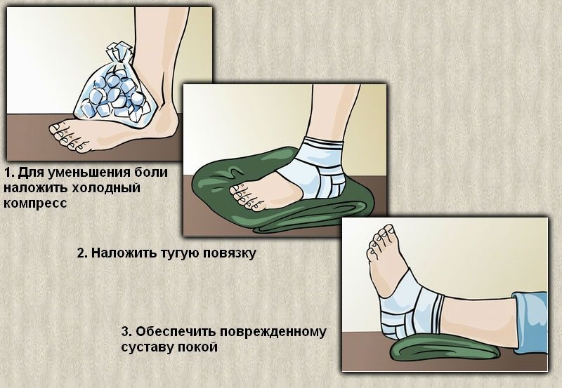 Помощь при травме голеностопа Помощь при травме голеностопа