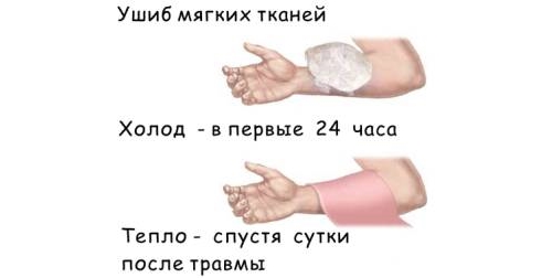 Помощь при ушибе мягких тканей Помощь при ушибе мягких тканей