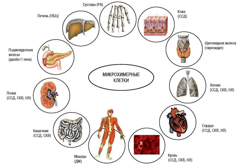 Поражение организма ревматоидным фактором Поражение организма ревматоидным фактором
