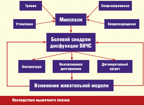 Последствия мышечного спазма Последствия мышечного спазма