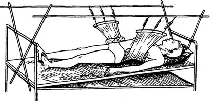 Постельный режим при травме позвоночника Постельный режим при травме позвоночника