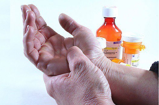 Потеря подвижности сустава Потеря подвижности сустава