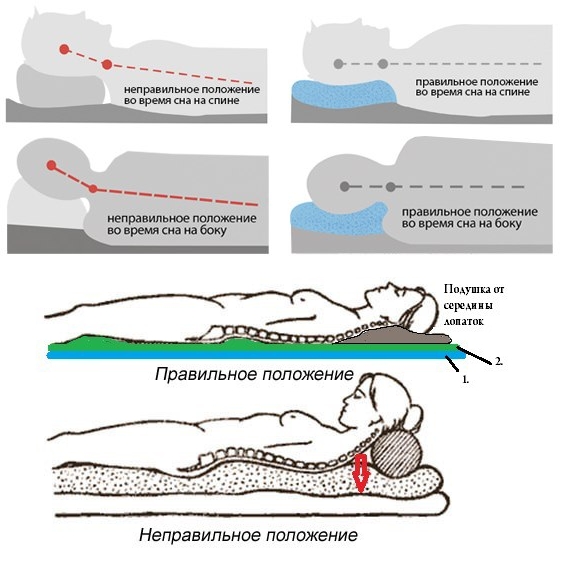 Правильное положение во время сна Правильное положение во время сна