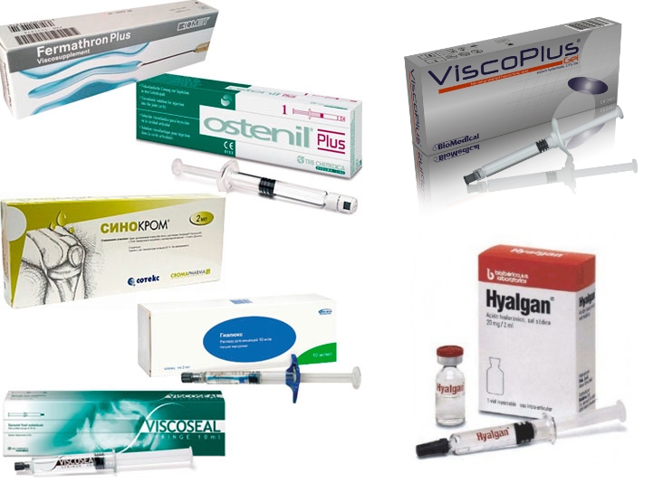 Препараты гиалуроновой кислоты для суставов Препараты гиалуроновой кислоты для суставов