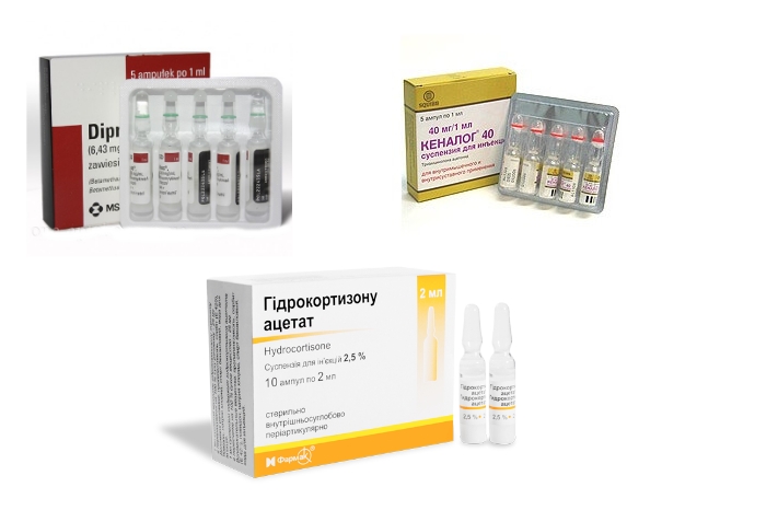 Препараты для инъекций при пяточной шпоре Препараты для инъекций при пяточной шпоре