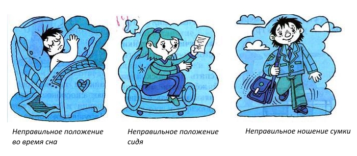 Частые причины нарушения осанки Частые причины нарушения осанки