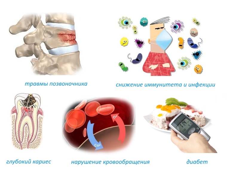 Причины остеомиелита Причины остеомиелита
