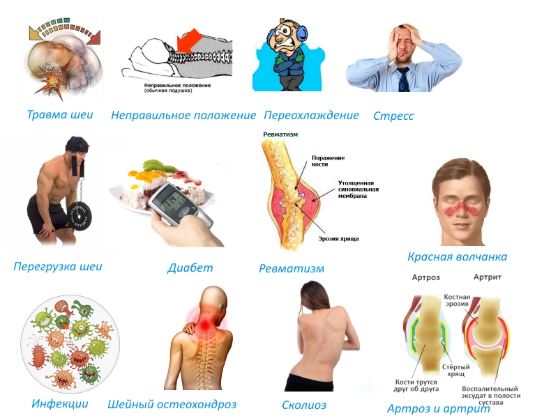 Причины острого миозита Причины острого миозита