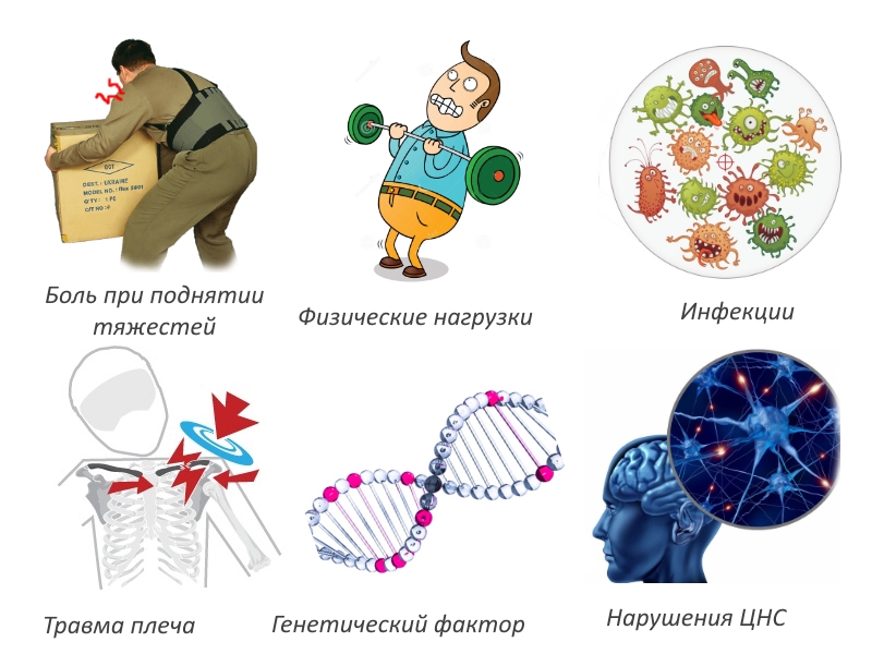 Причины плечевого бурсита Причины плечевого бурсита