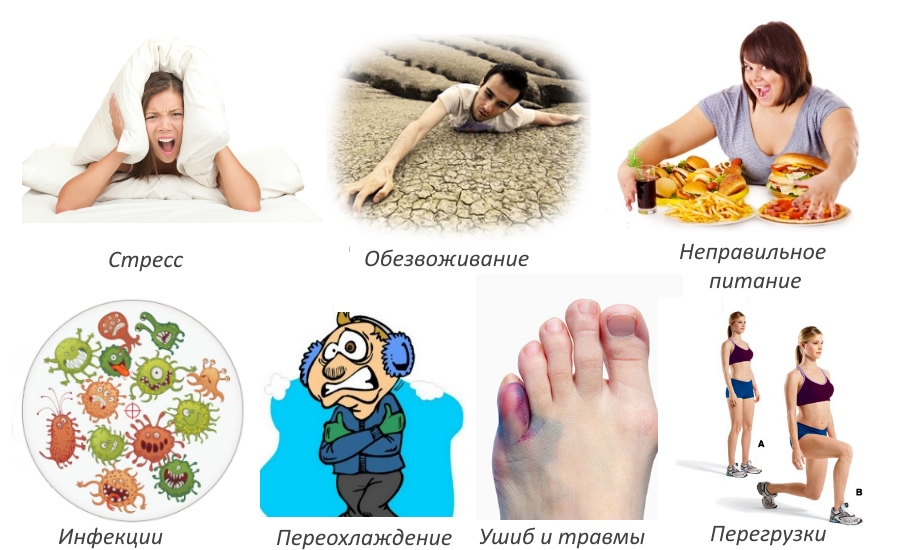 Причины подагрического артрита Причины подагрического артрита