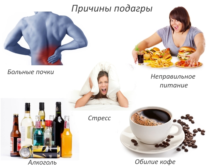 Причины подагры Причины подагры