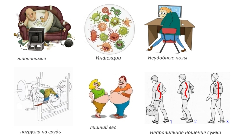 Причины шейного остеохондроза Причины шейного остеохондроза