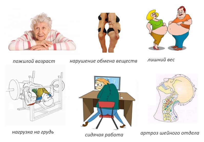 Причины шейного спондилеза Причины шейного спондилеза