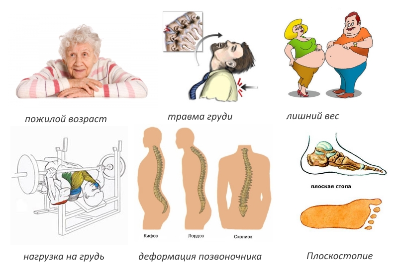 Причины спондилоартроза Причины спондилоартроза