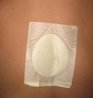 Применение пластыря в области боли Применение пластыря в области боли