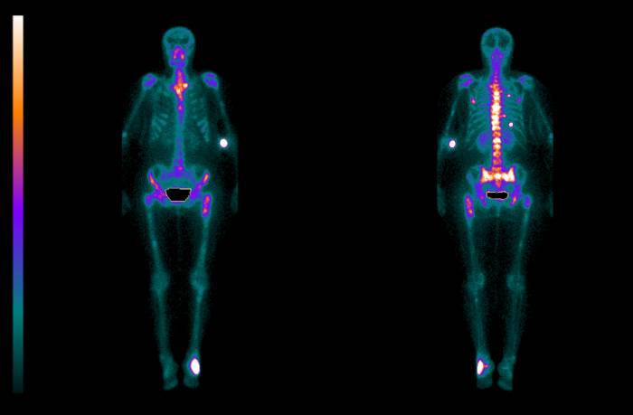 Пример результатов сканирования скелета Пример результатов сканирования скелета