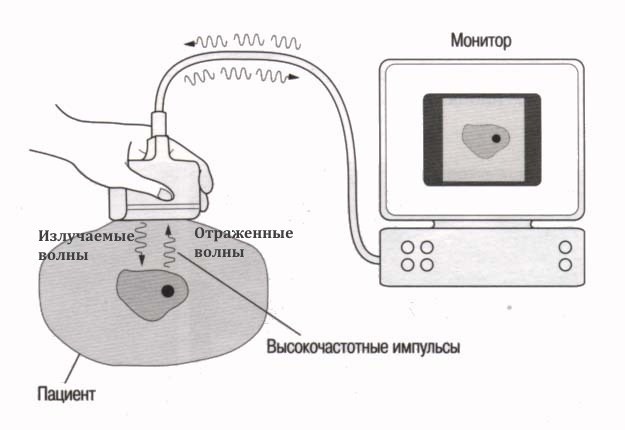Принцип УЗИ диагностики Принцип УЗИ диагностики
