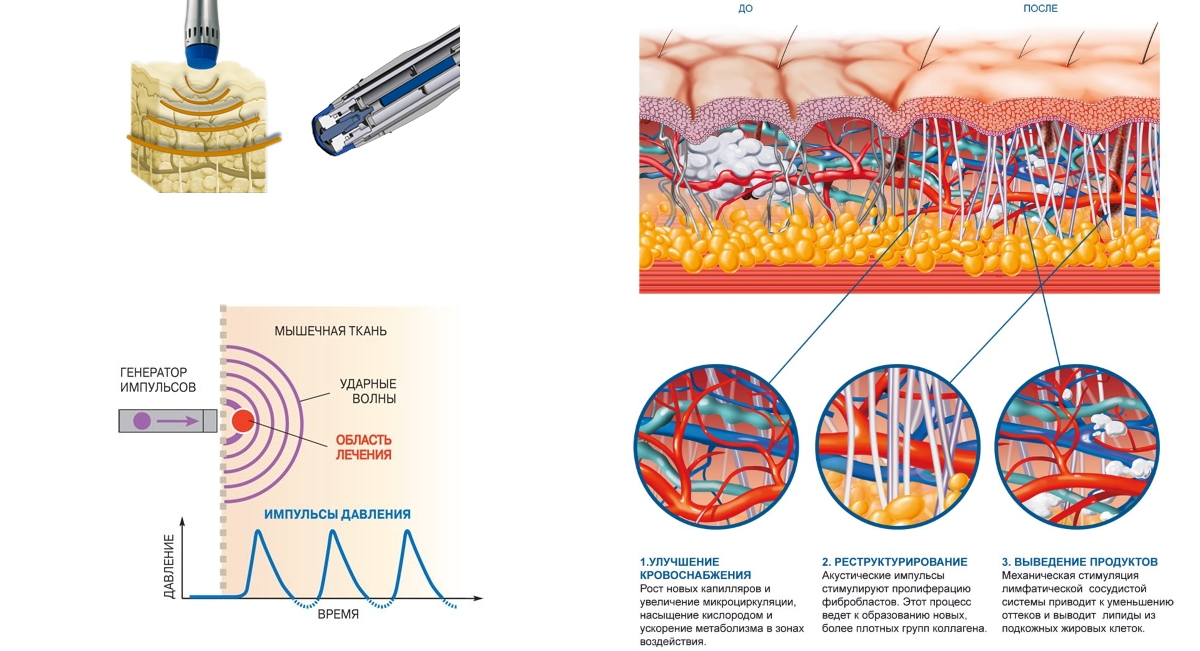 Принцип действия УВТ Принцип действия УВТ