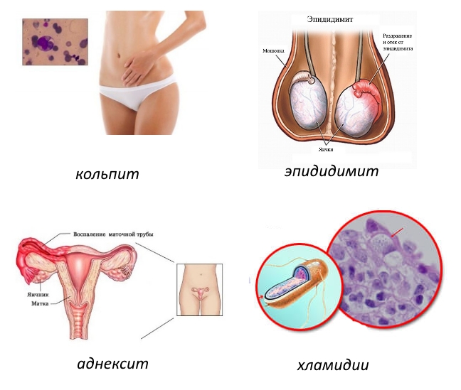 Возможные признаки болезни Рейтера Возможные признаки болезни Рейтера