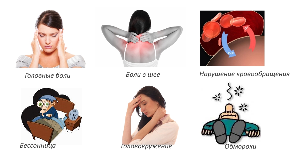 Признаки грыжи шейного отдела позвоночника Признаки грыжи шейного отдела позвоночника