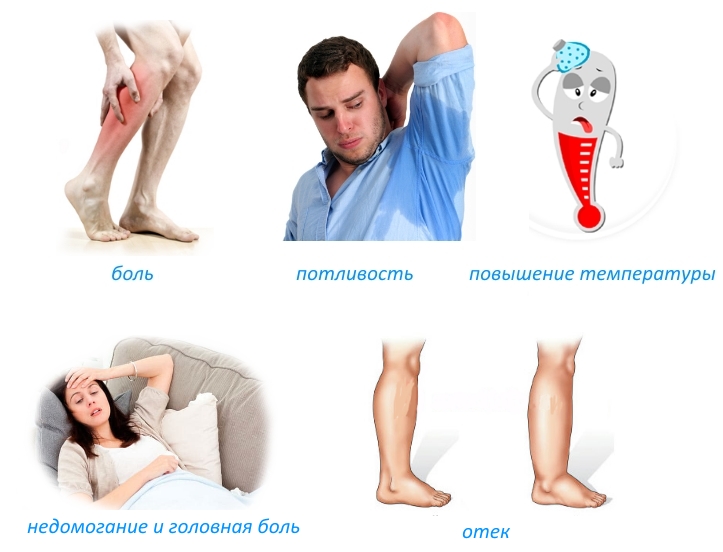 Признаки появления остеомиелита Гарре Признаки появления остеомиелита Гарре