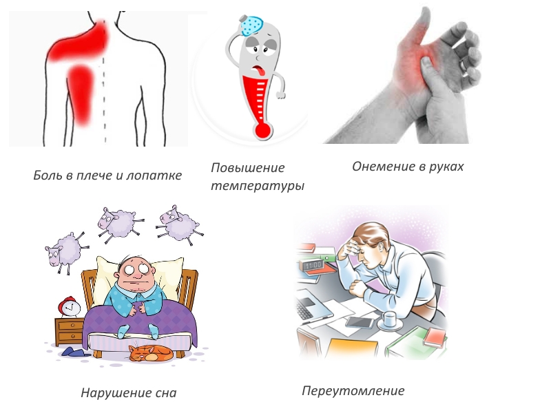 Признаки периартрита плеча Признаки периартрита плеча