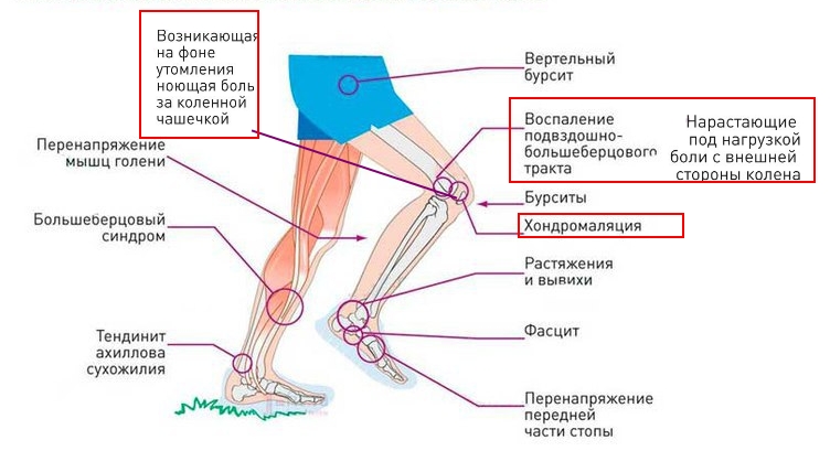 Проблемы бегуна Проблемы бегуна