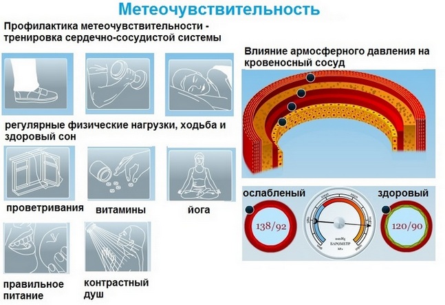 Профилактика метеочувствительности Профилактика метеочувствительности