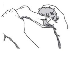 Прогревание соляным мешочком Прогревание соляным мешочком