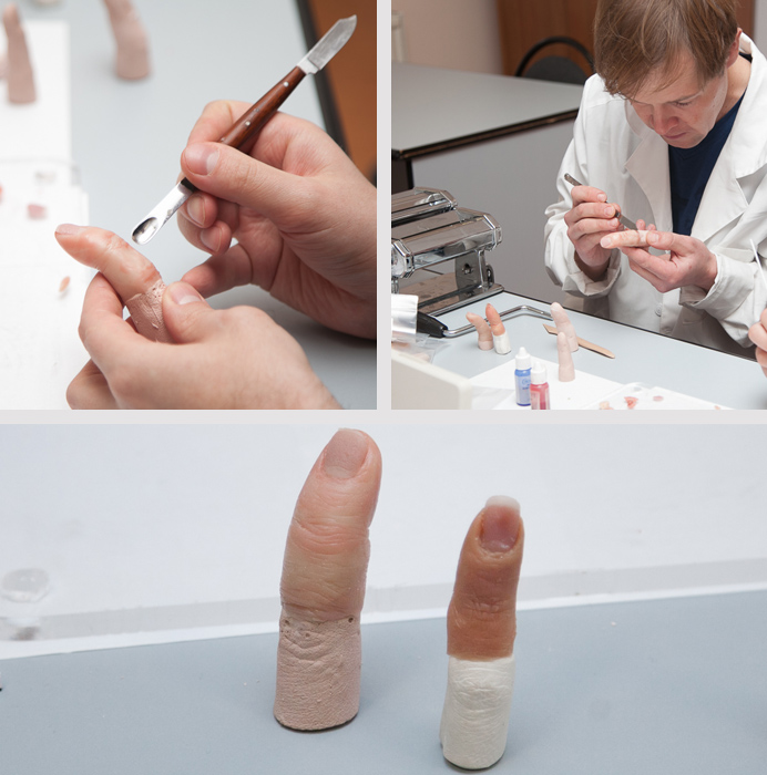 Силиконовый протез пальца Силиконовый протез пальца