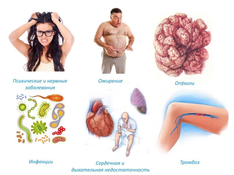 Противопоказания для операции Противопоказания для операции