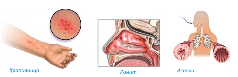Противопоказания для мази Долгит Противопоказания для мази Долгит
