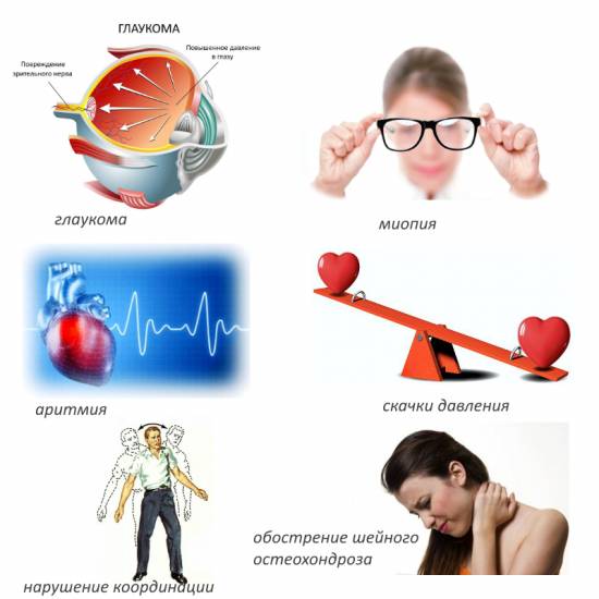 Противопоказания для гимнастики при шейном остеохондрозе Противопоказания для гимнастики при шейном остеохондрозе