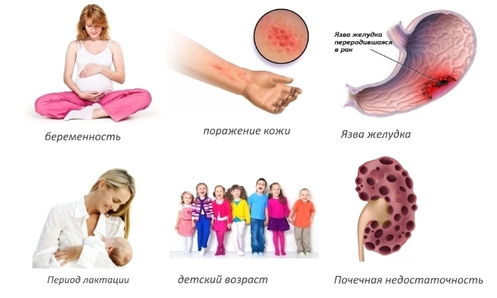 Противопоказания для Хондроксида форте Противопоказания для Хондроксида форте