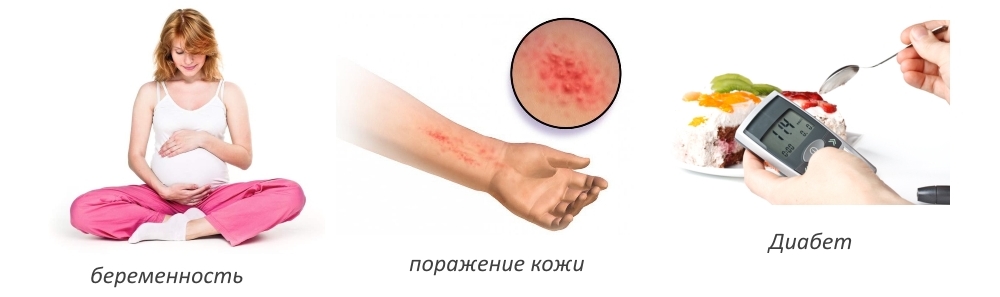 Противопоказания для проведения операции при кисте Противопоказания для проведения операции при кисте