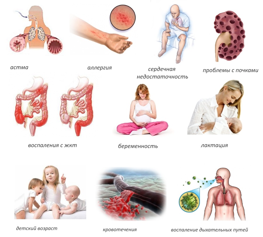 Противопоказания для свечей Амелотекса Противопоказания для свечей Амелотекса