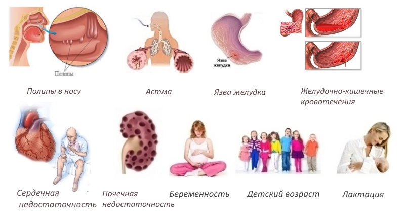 Противопоказания свечей Противопоказания свечей