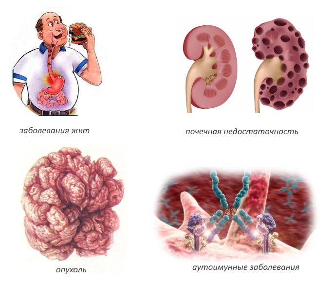 Основные противопоказания для Остеомеда Основные противопоказания для Остеомеда