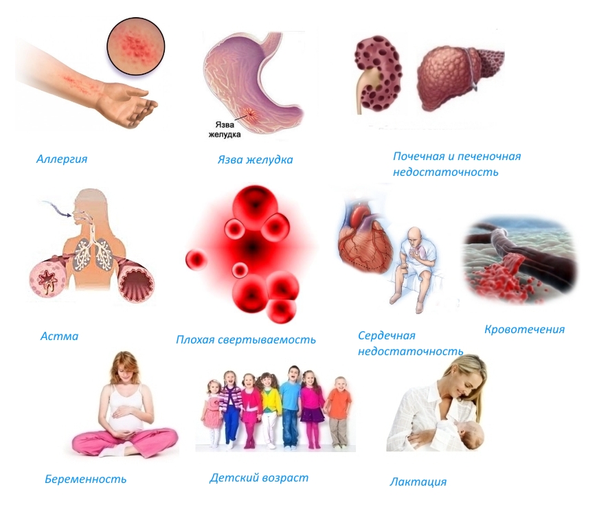 Противпоказания для приема Артроксана Противпоказания для приема Артроксана