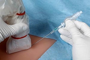 Пункция крови гематомы