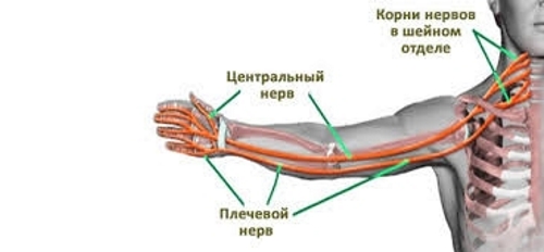 Распространение неврита по всей руке Распространение неврита по всей руке