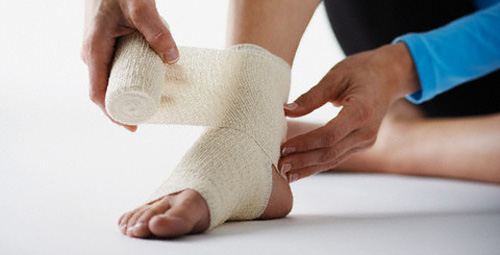 Лечение растяжения