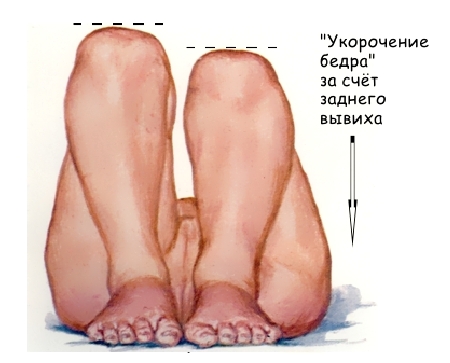 Различная длина ножек