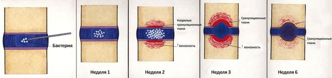 Разрушение диска Разрушение диска