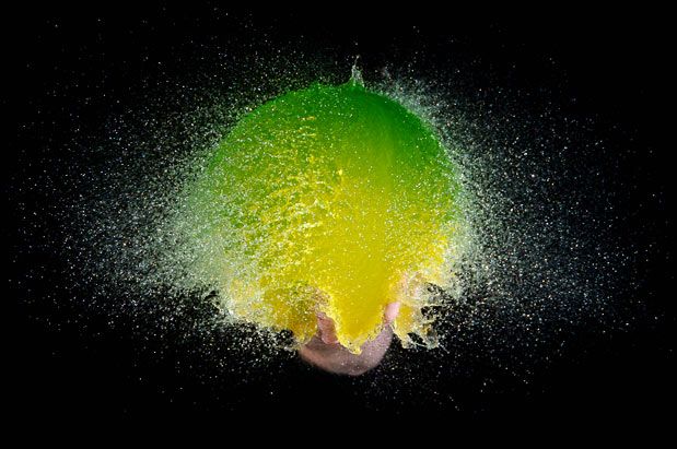 Разрыв подколенной кисты Разрыв подколенной кисты