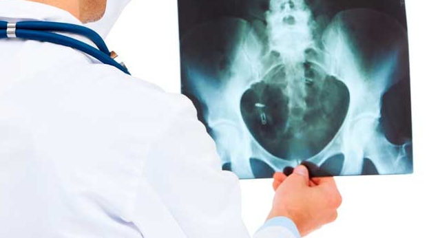 Рентген диагностика сустава