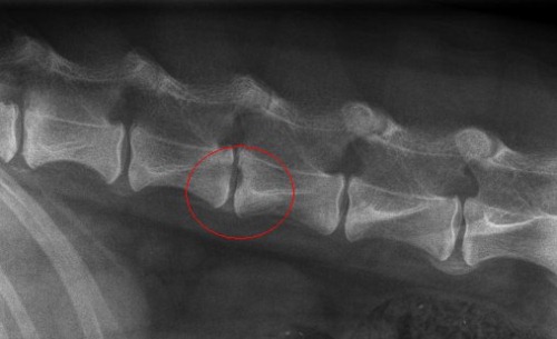 Суставная щель при грыже позвоночника Суставная щель при грыже позвоночника