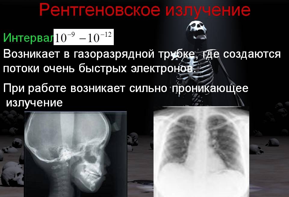 Рентген излучение Рентген излучение