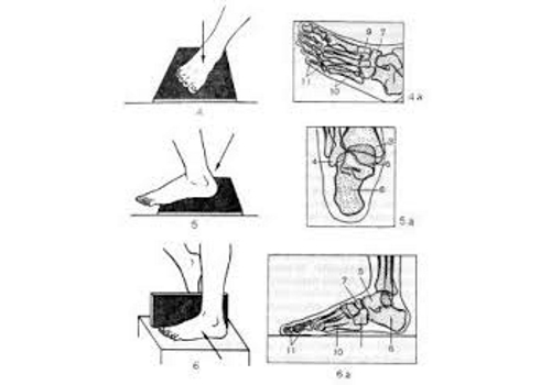 Рентген стопы в разных проекциях Рентген стопы в разных проекциях