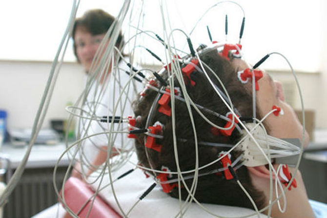 Реоэнцефалография